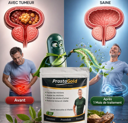 ProstaGold